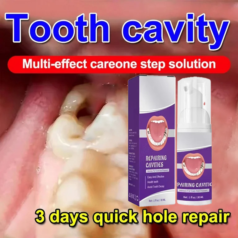 Teeth Whitening Uv - Teeth Cleaning Toothpaste Removes Tooth Stains