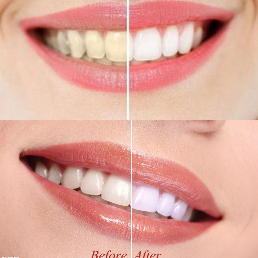 Bamboo Charcoal Teeth Tooth De - Teeth Whitening Zimba ulasan dan harga