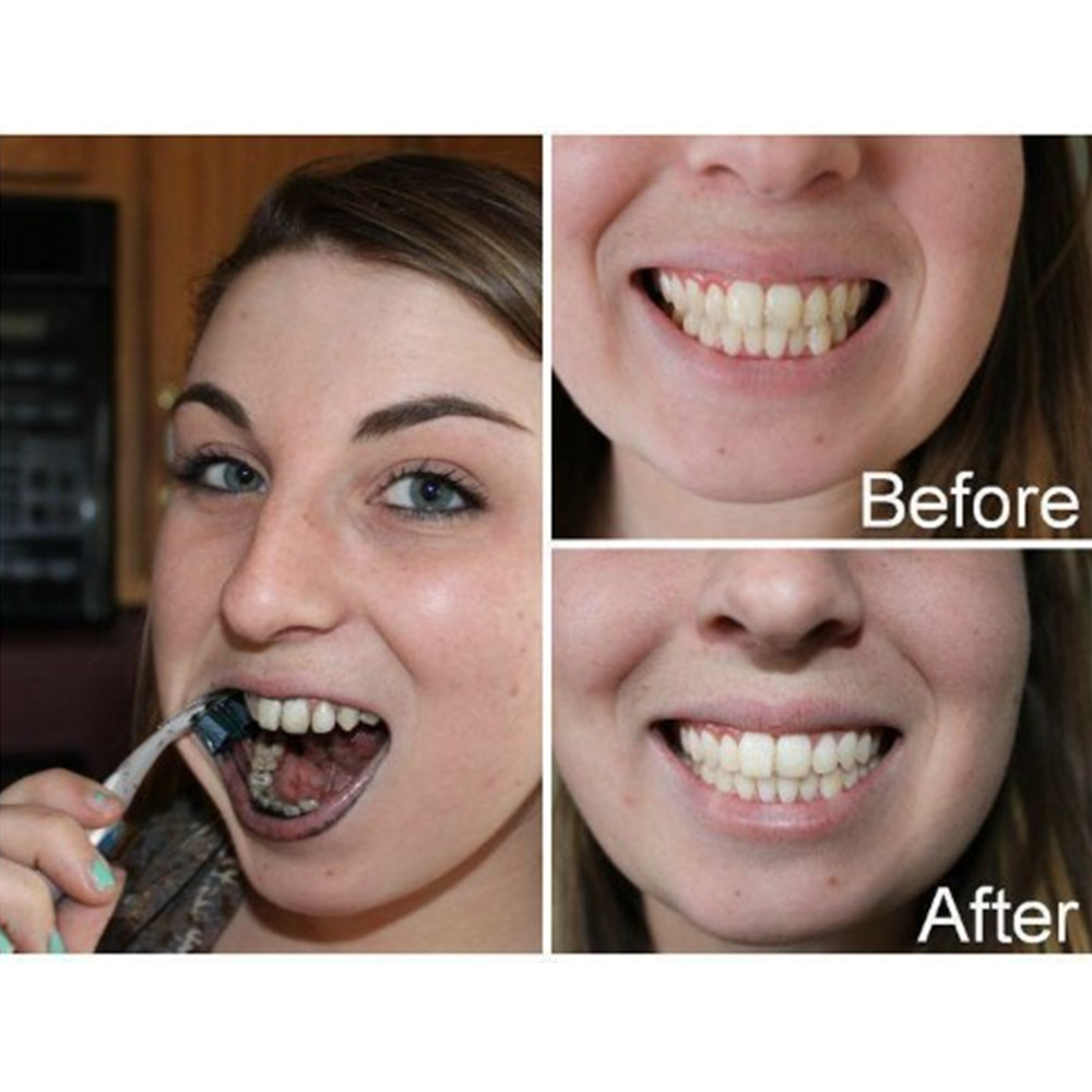 Bamboo Charcoal Teeth Tooth De - Teeth Whitening Zimba ulasan dan harga