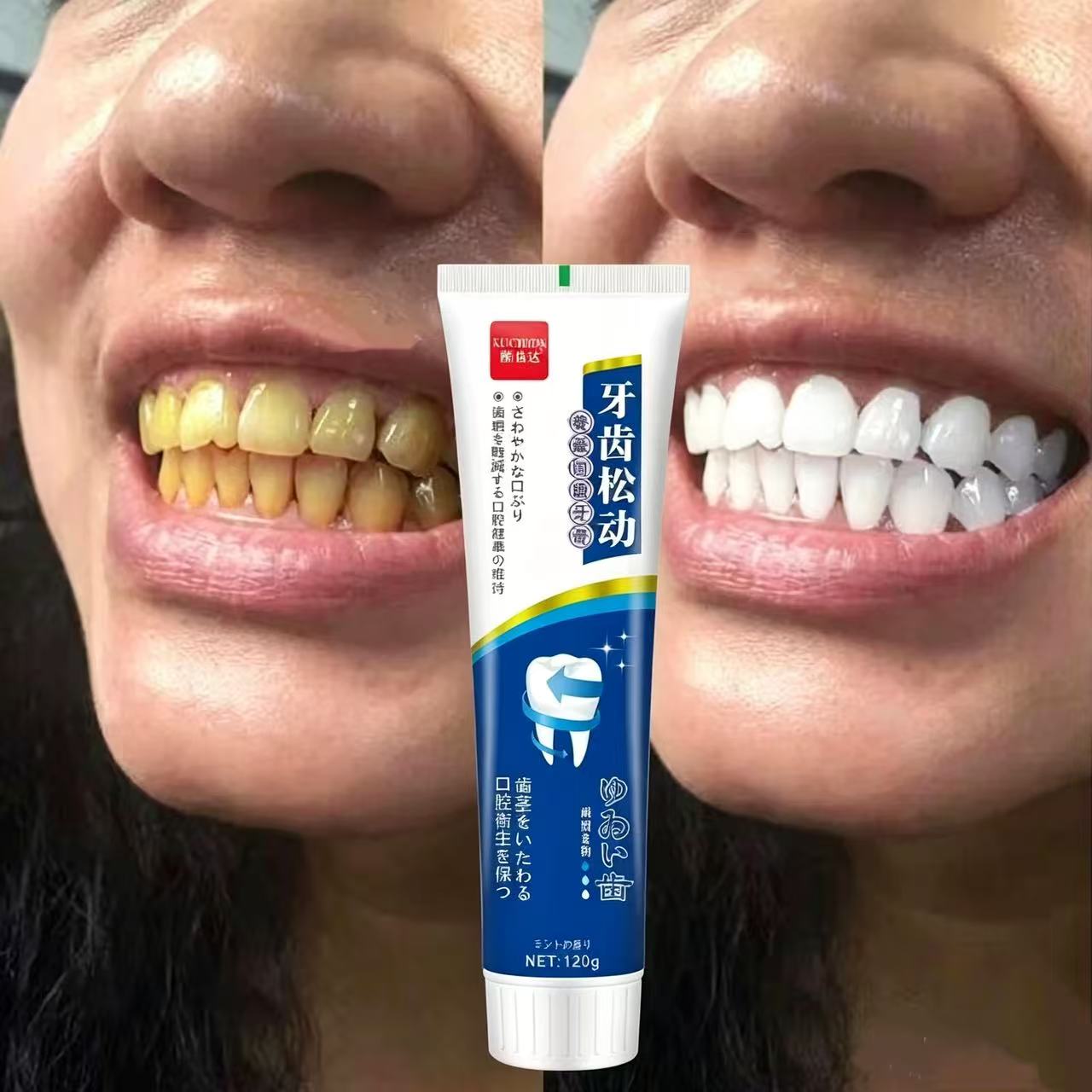 Fix Loose Teeth Japanese Impor - Teeth Whitening Japan ulasan dan harga