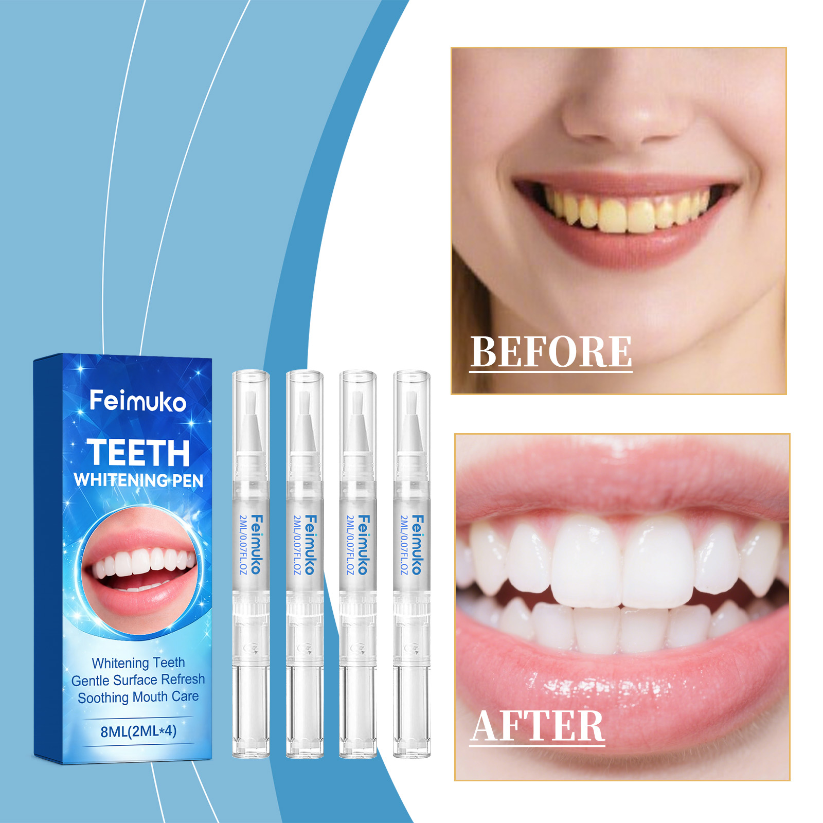 Feimuko 8ml Teeth Gel Pen Gent - Teeth Whitening Pens ulasan dan harga