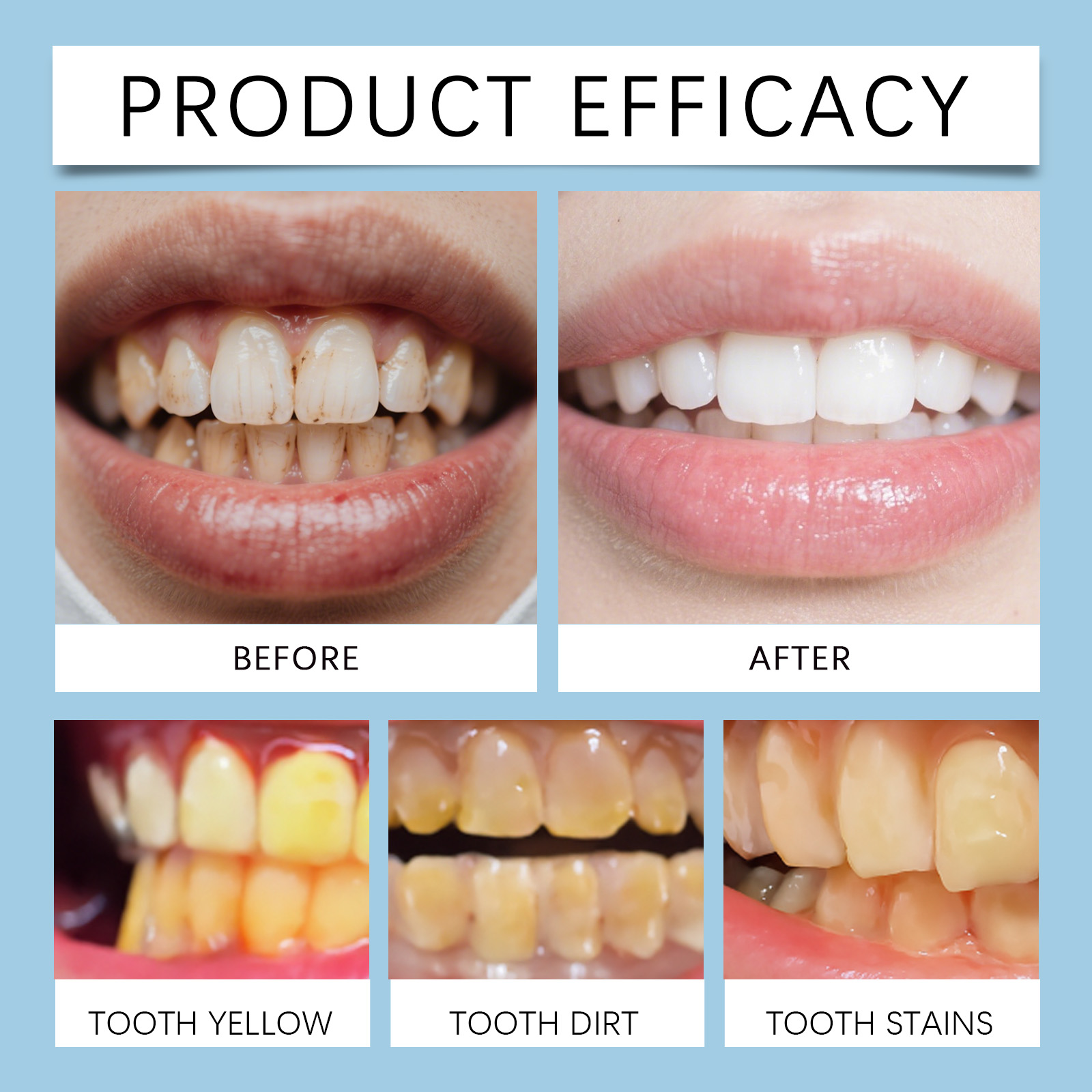 Feimuko 8ml Teeth Gel Pen Gent - Teeth Whitening Pens ulasan dan harga