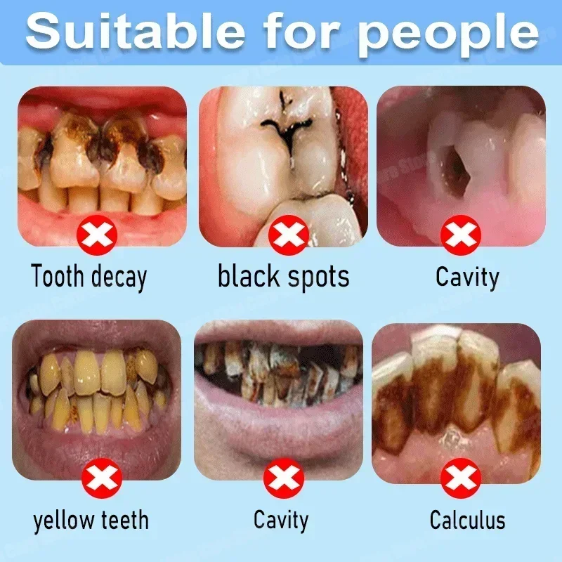 Anti Decay Toothpaste Repairs  - Teeth Whitening Uv ulasan dan harga