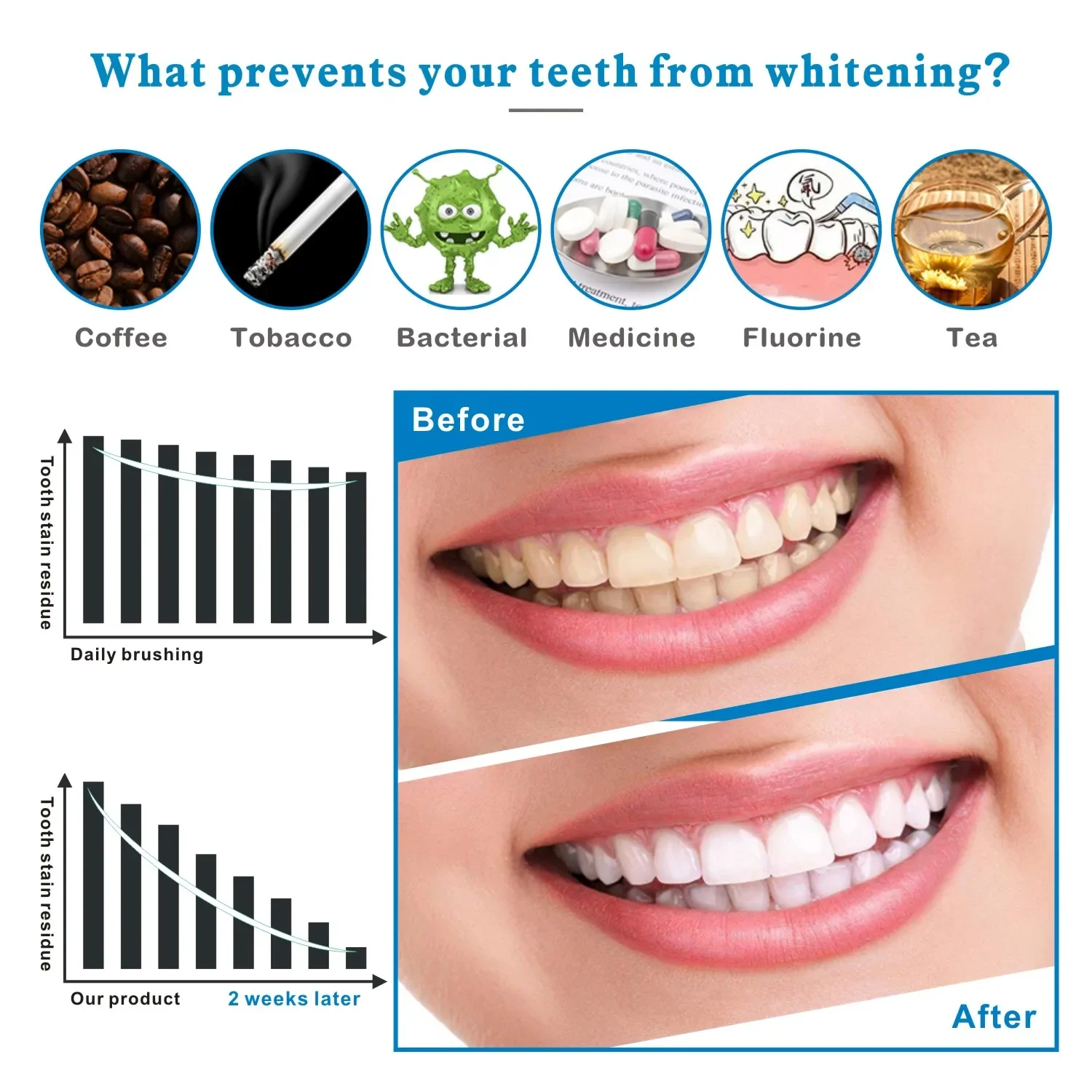 14/28pcs 3D Teeth Whitening St - Teeth Whitening Effects ulasan dan harga