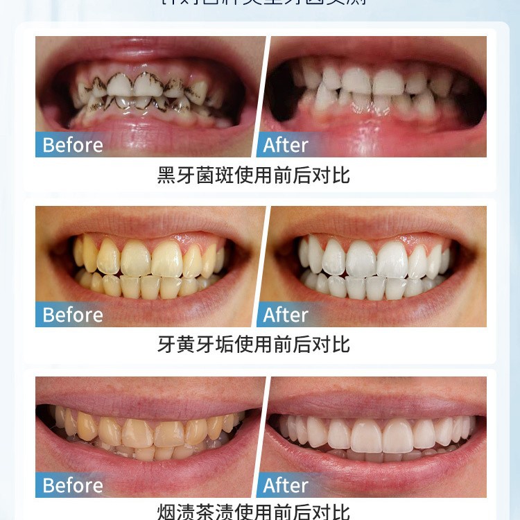 Japan Manual Tooth Stain Remov - Teeth Whitening Japan ulasan dan harga