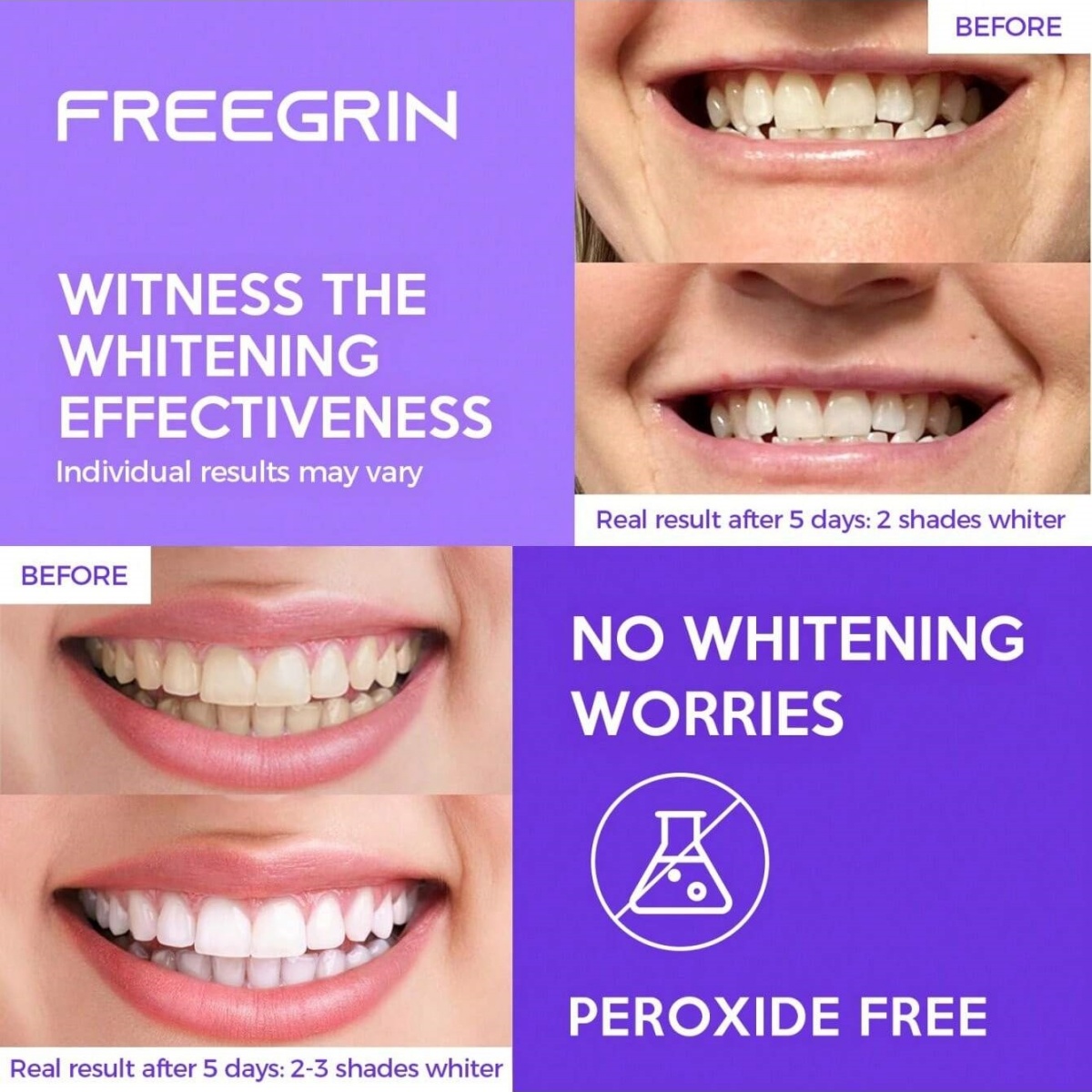 Deluxe Whitening Teeth Sticker - Teeth Whitening Gel Refills ulasan dan harga