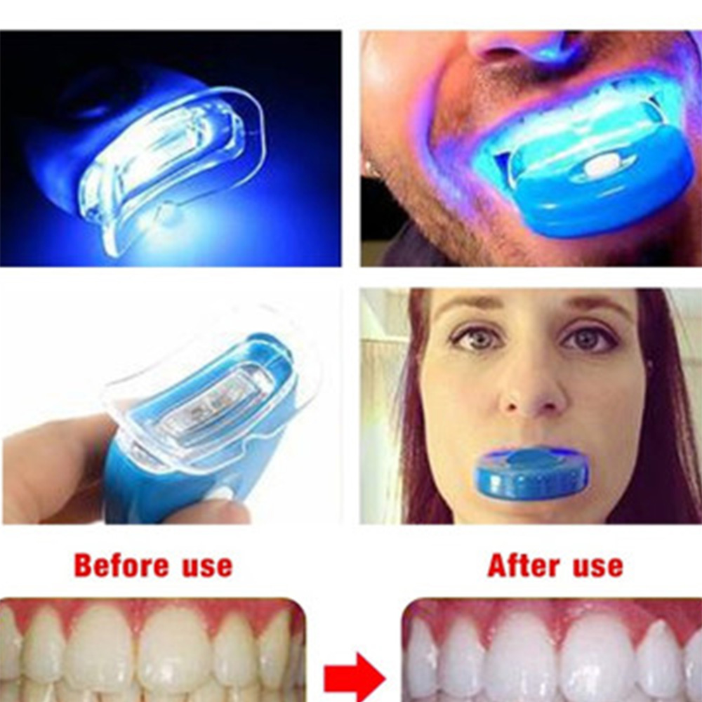 New Blue Led Teeth Whitening A - Teeth Whitening Uv ulasan dan harga