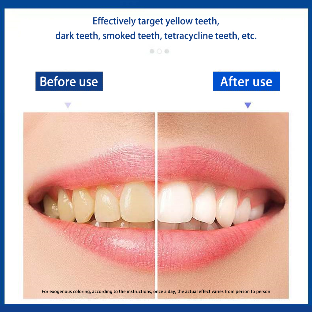 70/140 Pairs 5D White Teeth Wh - Teeth Whitening Effects ulasan dan harga