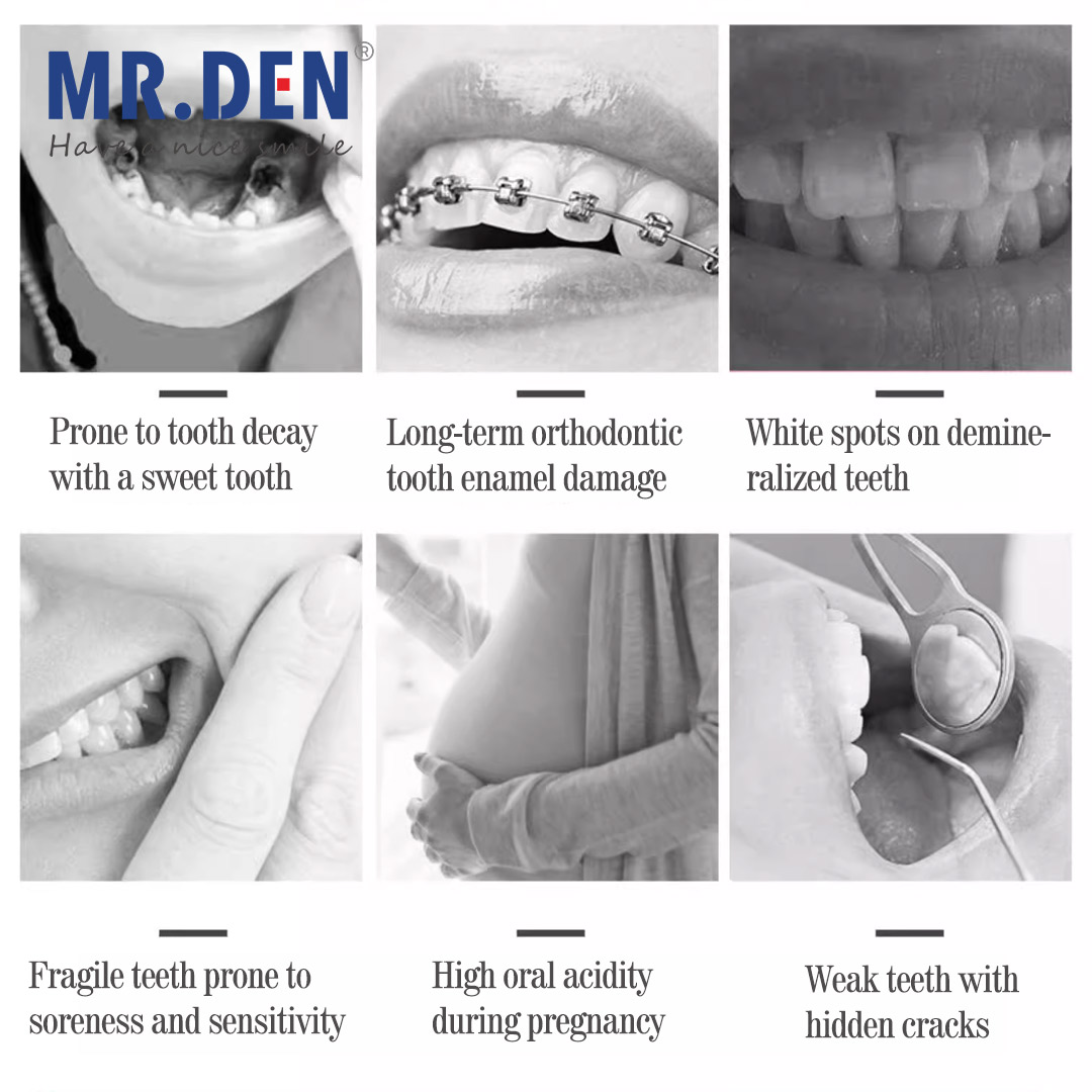 Japan GC Fluoride Enhanced Den - Teeth Whitening Japan ulasan dan harga