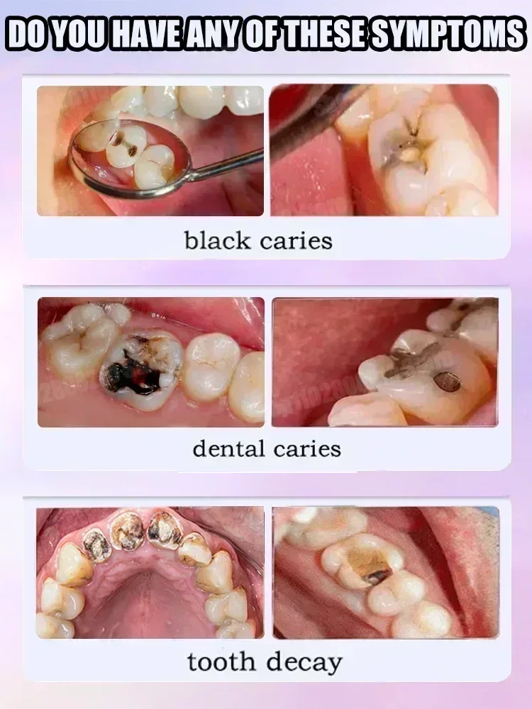 Teeth Cleaning Toothpaste Remo - Teeth Whitening Uv ulasan dan harga